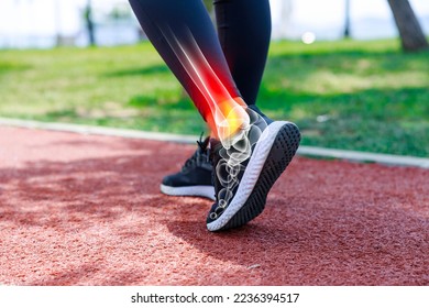 Female athlete walking on track field, low angle view of her shoes and ankle with x-ray image showing sportive injury. Sports injuries concept - Powered by Shutterstock