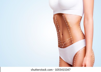 Female body cosmetic surgery and skin liposuction.