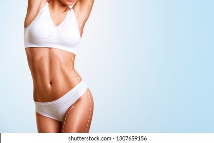 Female Body, Cosmetic Surgery And Skin Liposuction.