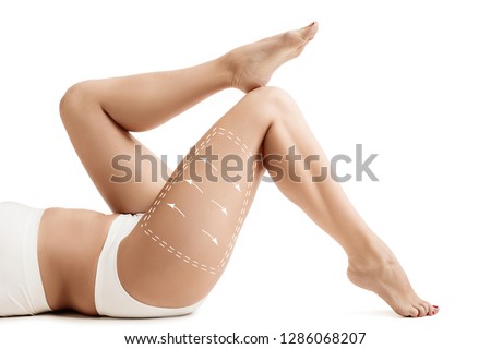 Female body with the drawing arrows. Fat lose, liposuction and cellulite removal concept. Marks on the women's buttocks, waist and legs before plastic surgery. The concept of plastic surgery