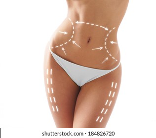 Female body and the drawing arrows it isolated white  Fat lose  liposuction   cellulite removal concept 