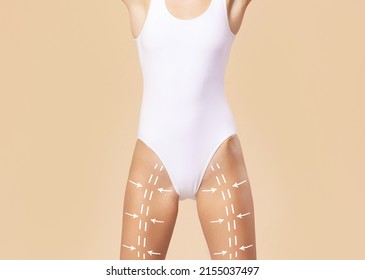 Female body with the drawing arrows on it. Fat lose, liposuction and cellulite removal.