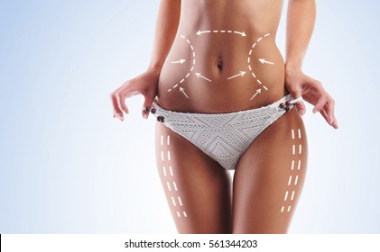 Female body with the drawing arrows on it. Fat lose, liposuction and cellulite removal concept.