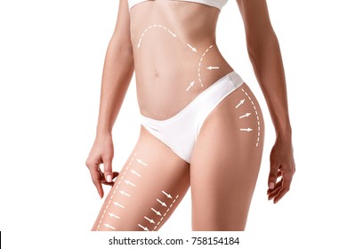 Female body and the drawing arrows it isolated white  Fat lose  liposuction   cellulite removal concept 