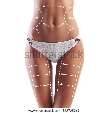 Female body with the drawing arrows on it. Fat lose, liposuction and cellulite removal concept.