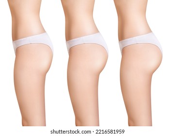 Female buttocks before and after augmentation. Isolated on white background.