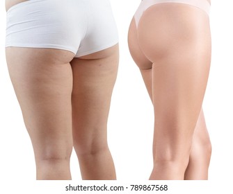 Female buttocks before and after spont and properly food. - Shutterstock ID 789867568