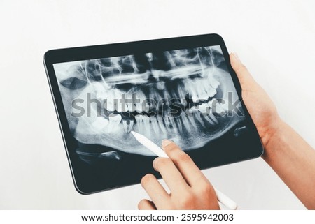 female dentist shows the patient his x-ray, the x-ray is of an old young male female and explains the procedure and treatment he will receive on his teeth, the x-ray shows the damage to the teeth.