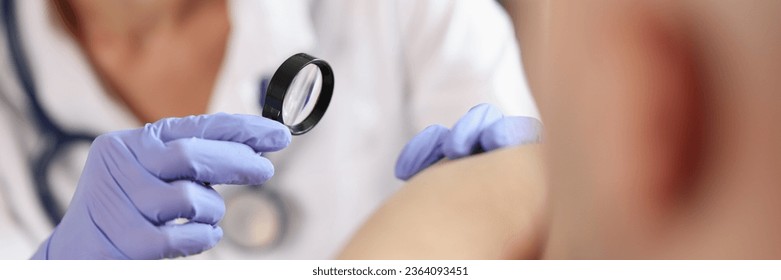 Female dermatologist examining patient skin with magnifying glass at consultation in hospital. Dermatology and skin diseases concept. - Powered by Shutterstock