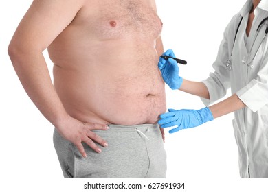 Female Doctor Applying Marks Onto Belly Of Fat Man On White Background. Weight Loss Surgery Concept