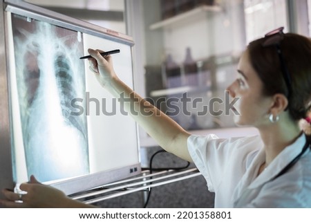 Female doctor checking anatomy and physiology x-ray film of patient in the hospital