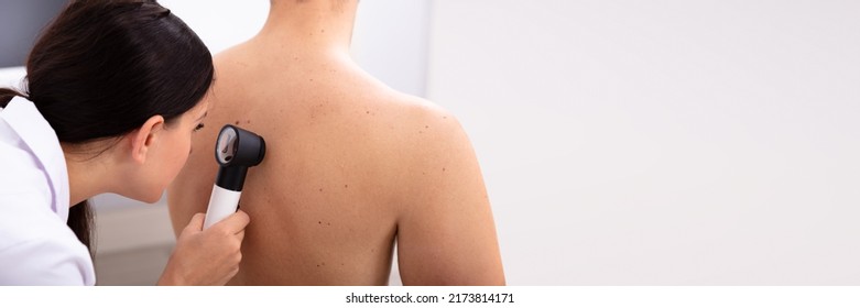 Female Doctor Examining Pigmented Skin On Man's Back With Dermatoscope