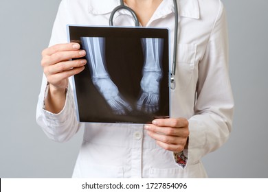 Female doctor examining x-ray image of legs of newborn baby. Isolated over gray background