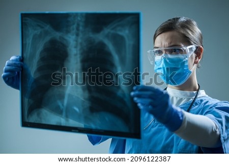 Female doctor in hospital holding patient x-ray film,radiologist studying radiography result,radiology specialist interpreting COVID-19 patient chest scan on asthma,lung disease or bone cancer illness