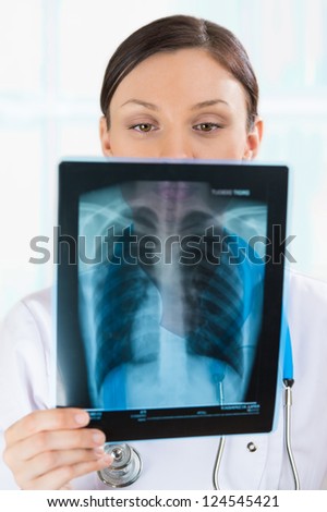 Female doctor looking at a lungs or torso xray, fluorography