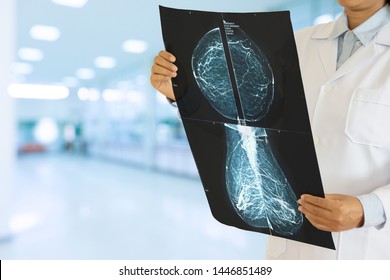female doctor looking at the Mammogram X-ray film image with blurred hospital background.