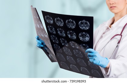 Female Doctor looking at a tomography x-ray picture of Eyes.