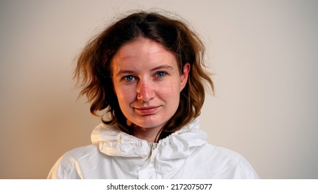 Female Doctor Takes Off Glasses Protective Suit And Mask, Face Marks Are Visible