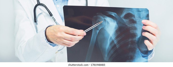 Female doctors hand pointing at x-ray medical imaging with a shoulder condition. Bone health, impingement. Orthopedics medicine. Healthcare and medicine. Injury. SLAP lesion. Medical banner - Shutterstock ID 1781948483