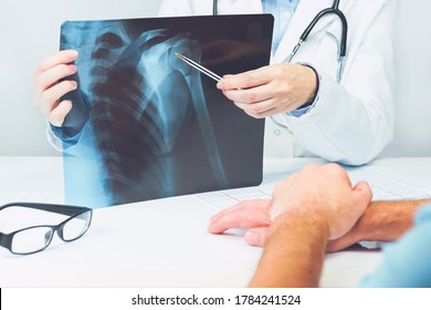 Female Doctors Hand Pointing At X-ray Medical Imaging With A Shoulder Condition. Bone Health, Impingement. Orthopedics Medicine. Healthcare And Medicine. Injury. SLAP Lesion. Patient Visiting Doctor