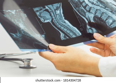 Female Doctors Hand Pointing At X-ray Or MRI Medical Imaging With A Head And Neck Condition. Spinal Cord, Blood Vessels. Neuro Medicine. Healthcare And Medicine. Injury. Bone Tissues.