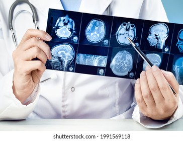 Female doctors hand pointing at x-ray or MRI medical imaging with a head and neck condition. Spinal cord, blood vessels. Neuro medicine. Healthcare and medicine. Brain tissues.