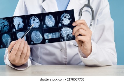 Female Doctors Hand Pointing At X-ray Or MRI Medical Imaging With A Head And Neck Condition. Spinal Cord, Blood Vessels. Neuro Medicine. Healthcare And Medicine. Brain Tissues.