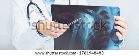 Female doctors hand pointing at x-ray medical imaging with a shoulder condition. Bone health, impingement. Orthopedics medicine. Healthcare and medicine. Injury. SLAP lesion. Medical banner