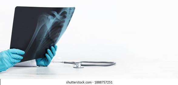 Female Doctors Hands Holding An X-ray Medical Imaging With A Shoulder Condition. Bone Health, Impingement. Orthopedics Medicine. Healthcare And Medicine. Injury. SLAP Lesion. Medical Banner