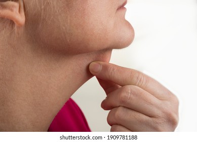 Female double chin from profile for the surgery