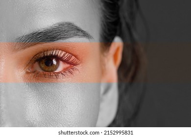 Female Eye With Red Vessels And Inflammation, Dry Eye Syndrome, Close-up