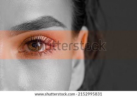 Female eye with red vessels and inflammation, dry eye syndrome, close-up