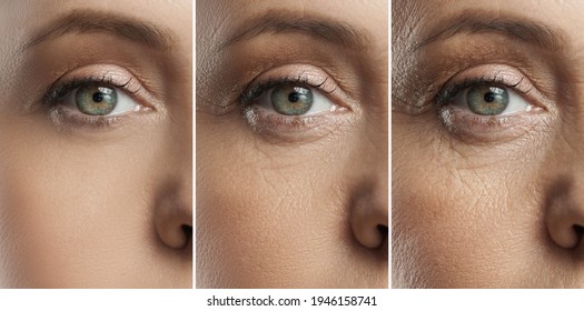 Female eye representing aging concept. Comparison of young, middle aged and elderly age.