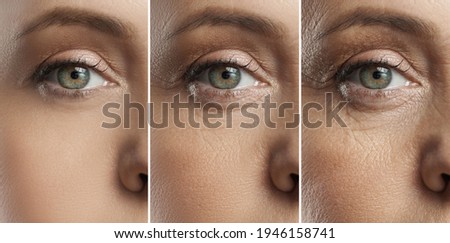 Female eye representing aging concept. Comparison of young, middle aged and elderly age.