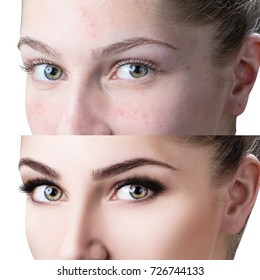 Female eyes before and after eyelash extension