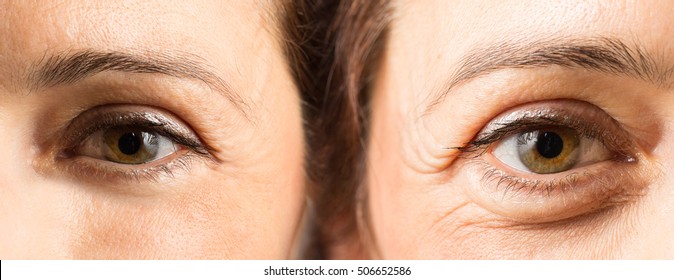 Female eyes with and without wrinkles