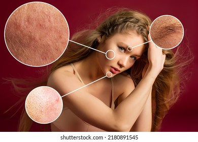 Female face close-up, show skin problems. Dry skin, acne, wrinkles, and other imperfections. On red background