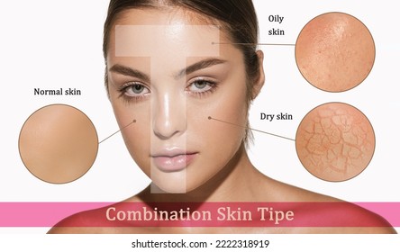 Female face with different skin types - dry, oily, normal, combination. T-zone. Skin problems. Beautiful brunette woman and facial diseases: acne, wrinkles. Skincare, healthcare, beauty, aging process - Shutterstock ID 2222318919