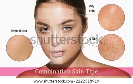 Female face with different skin types - dry, oily, normal, combination. T-zone. Skin problems. Beautiful brunette woman and facial diseases: acne, wrinkles. Skincare, healthcare, beauty, aging process