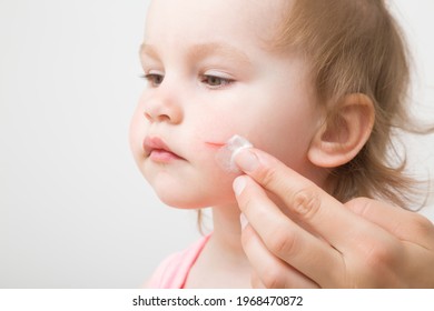 Female Finger Applying Medical Ointment On Scratched Cheek Skin Of Baby Girl. Isolated On Light Gray Background. Mother Giving First Aid. Toddler Head Closeup. Side View.