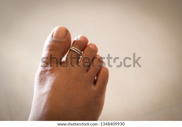 female foot with ring in\
toe