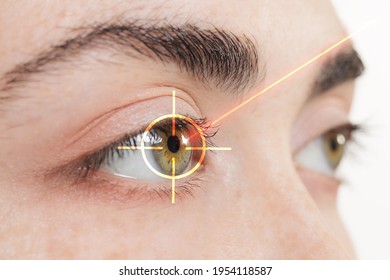 Female green eyes close-up. A laser beam is directed at the iris of the eye. Side view. The concept of laser vision correction.