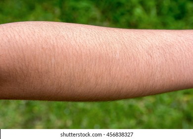 Female With Hairy Arm