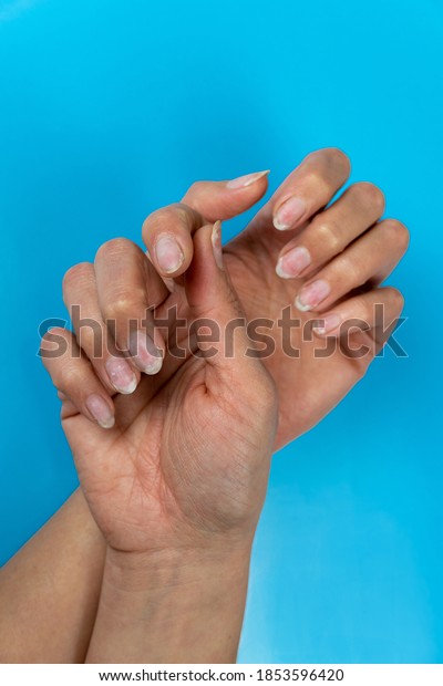 Female hands\
with nails affected by fungus on a blue background. Hand health and\
hygiene. Free space for\
text.