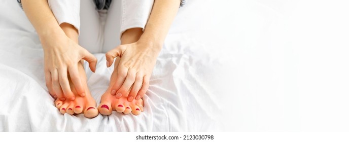 Female Hands Scratch Her Legs Sitting On Bed At Home. Itchy Skin, Redness, Fungus, Fungal Bacterial Infection, Allergic Reaction, Dermatitis Of The Foot. Health And Skincare Background, Copy Space.