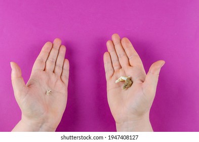 Female Hands Showing Teeth Of The Same Animal In Different Stages Of Life.  Two Molars Of One Dog. A Small Baby Tooth And The Adult Pet's Fallen Out Tooth. Tartar. Dental Health Of Pets. Veterinary