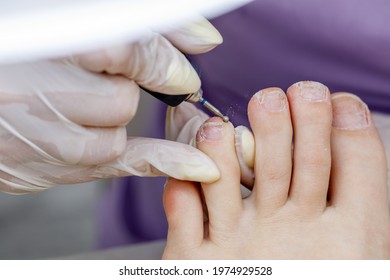 Female Hardware Pedicure In The Salon. Cutting The Cuticle Of The Thumbnail With A Round Cutter. Foot Hygiene In The Summer, Foot Care.