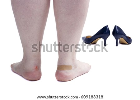 Female legs with callus on foot isolated on white background