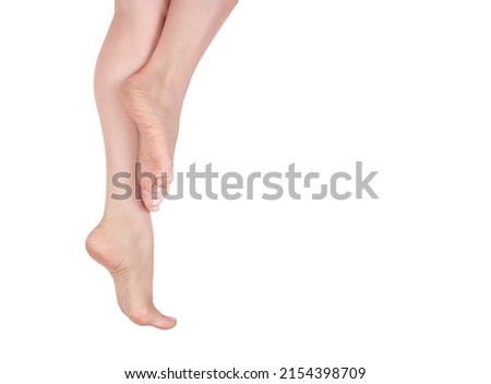 female legs with dry cracked skin on feet in an elegant position isolated on white background. treatment cosmetic and heel, skincare cosmetic and healthy concept. copy space