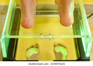 A Female Patient On A Foot Scanner In A Podiatry Clinic